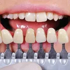 Unternehmen 4 Bild ZAHNARZT ORDINATION - DR. ERICH TRAUSCHKE, 1150 WIEN Ärzte am Wien 9