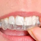 Unternehmen 5 Bild ZAHNARZT ORDINATION - DR. ERICH TRAUSCHKE, 1150 WIEN Ärzte am Wien 9