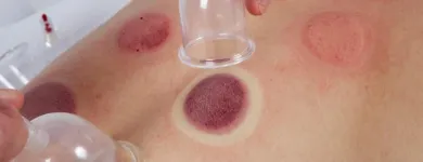 Unternehmen 2 Bild CHRISTIAN WALLISCH-SPORTMASSAGE-HEILMASSAGE-SPORTMASSEUR WIEN Massageinstitute am Wien 9